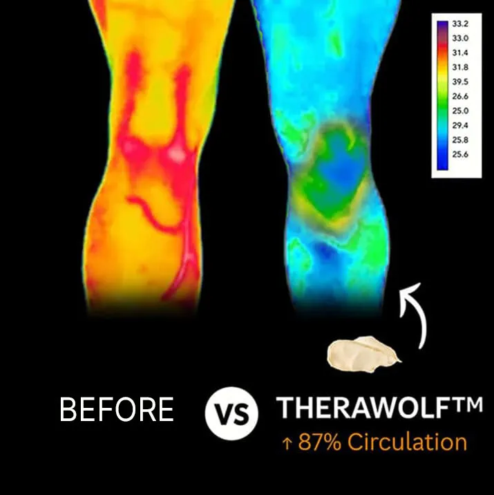 TheraWolf knee pain before after