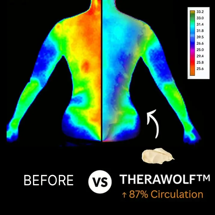 TheraWolf nerve pain and circulation